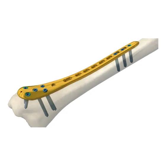 Orthopedic Implants